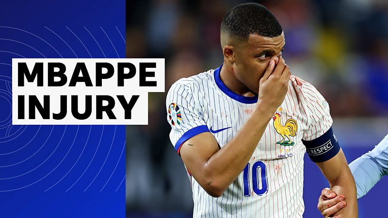 Captain Kylian Mbappe sustains a potentially broken nose during France's 1-0 win over Austria in their opening Euro 2024 game.